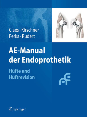 ﻿AE Manual of Arthroplasty: Hip and Hip Revision