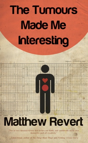 ﻿تومورها مرا جالب ساخته است