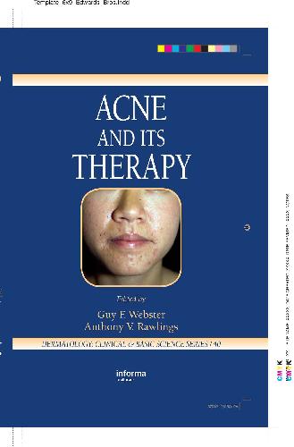 ﻿آکنه و درمان آن