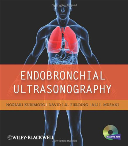 ﻿سونوگرافی Endobronchial