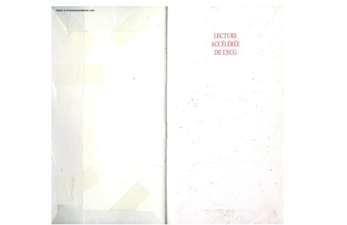 خواندن سریع ECG: آموزش برنامه ریزی شده برای تفسیر سیستماتیک الکتروکاردیوگرام