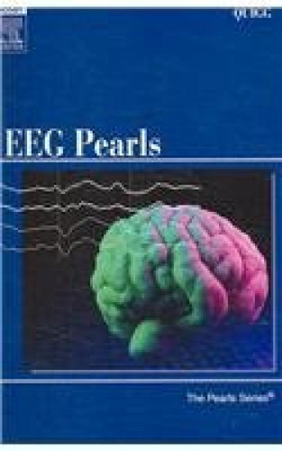 ﻿مروارید EEG