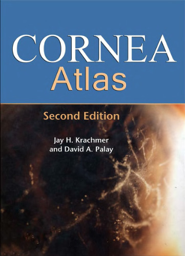 ﻿نسخه 2 اطلس قرنیه