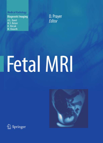 MRI جنین