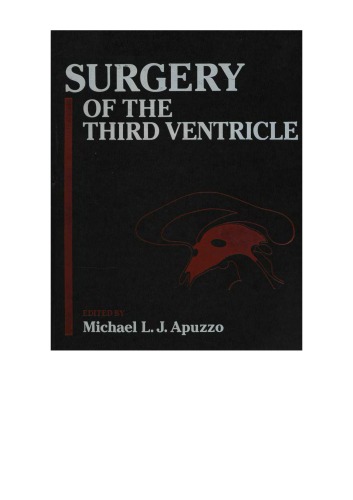 ﻿جراحی بطن سوم