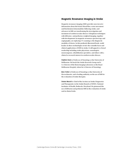 تصویربرداری تشدید مغناطیسی در سکته مغزی