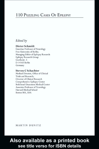 110 مورد گیج کننده از صرع