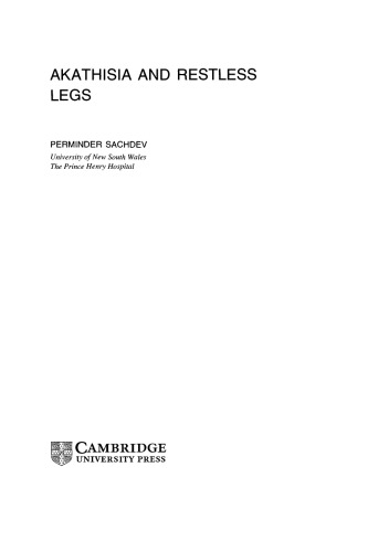 آکاتیزیا و پاهای بی قرار