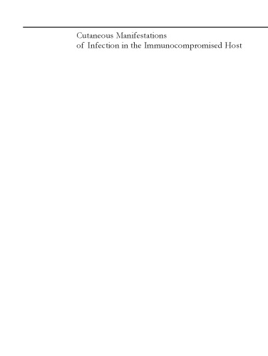 ﻿تظاهرات جلدی عفونت در میزبان نقص ایمنی