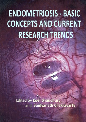 ﻿کیفیت جنین و نتیجه بارداری در بیماران نابارور با آندومتریوز
