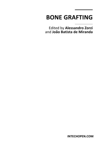 ﻿پیوند استخوان