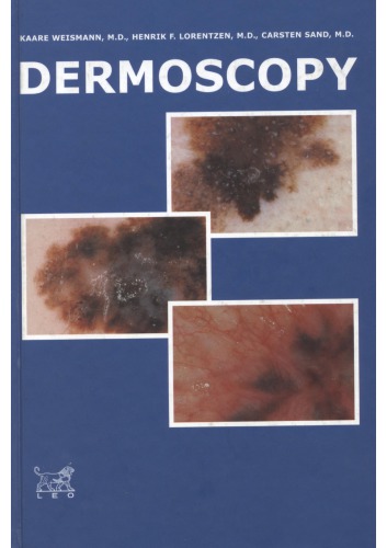 درماتوسکوپی