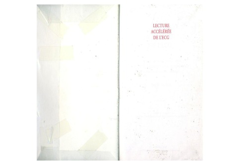 شتاب خواندن ECG: دستورالعمل برنامه ریزی شده