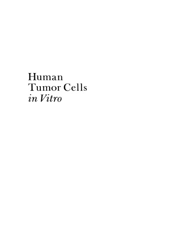 ﻿سلول های تومور انسانی در شرایط آزمایشگاهی