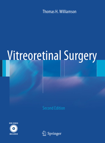 جراحی Vitreoretinal