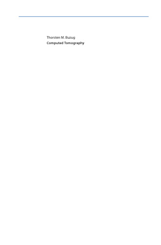 ﻿توموگرافی کامپیوتری: از آمار فوتون تا سی تی پرتو مخروطی مدرن