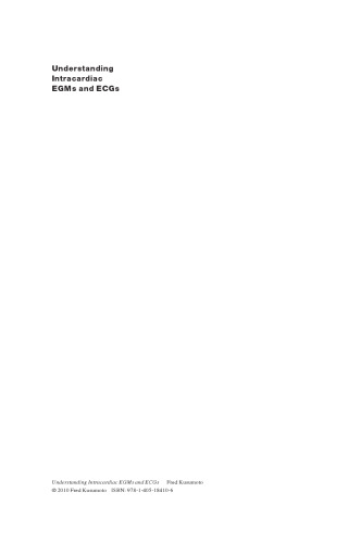 Understanding Intracardiac EGMs and ECGs
