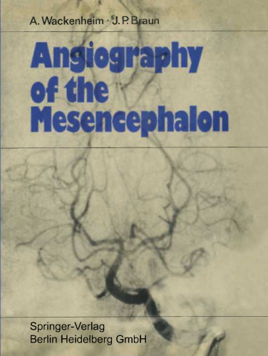 Angiography of the Mesencephalon: Normal and Pathological Findings