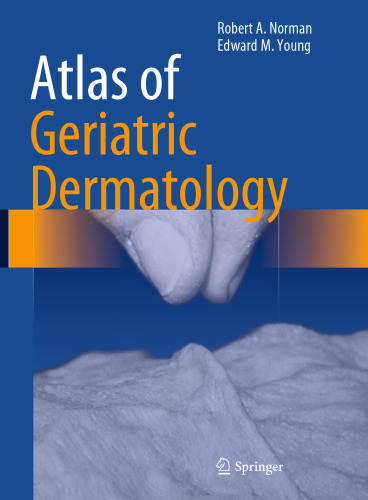 Atlas of Geriatric Dermatology