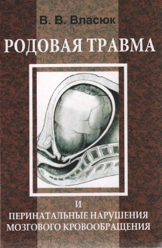 Родовая травма и перинатальные нарушения мозгового кровообращения