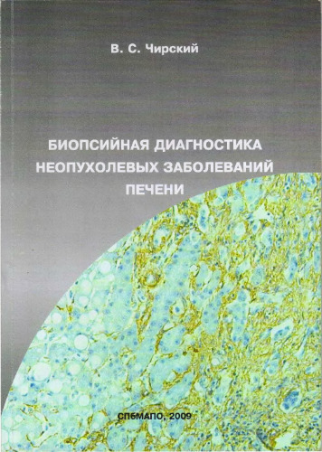 Биопсийная диагностика неопухолевых заболеваний печени
