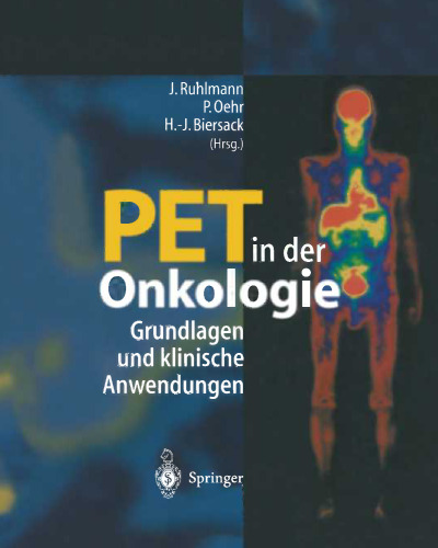 PET in der Onkologie: Grundlagen und klinische Anwendung