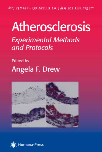 Atherosclerosis: Experimental Methods and Protocols