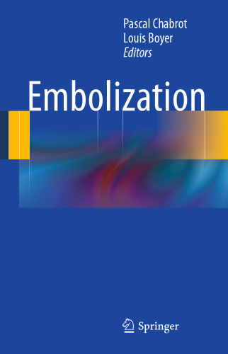 Embolization