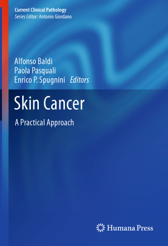 Skin Cancer: A Practical Approach