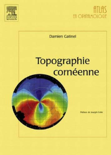 Topographie cornéenne