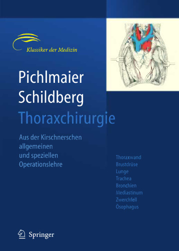 Thoraxchirurgie: Die Eingriffe an der Brust und in der Brusthöhle