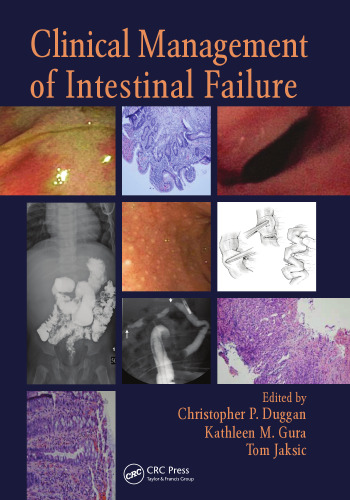 Clinical management of intestinal failure