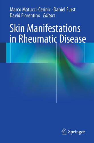 Skin Manifestations in Rheumatic Disease