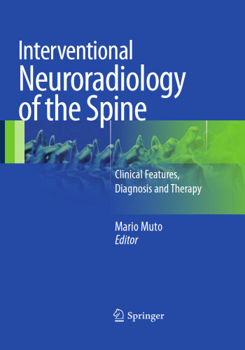Interventional Neuroradiology of the Spine: Clinical Features, Diagnosis and Therapy