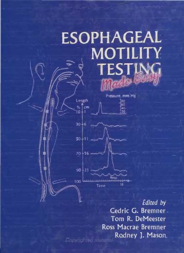 Esophageal motility testing made easy