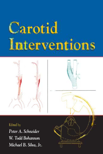 Carotid interventions