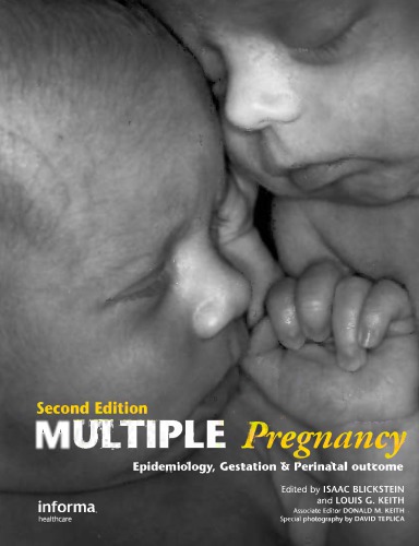 Multiple pregnancy