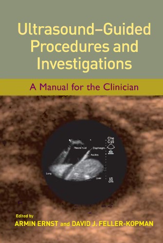 Ultrasound-guided procedures and investigations: a manual for the clinician