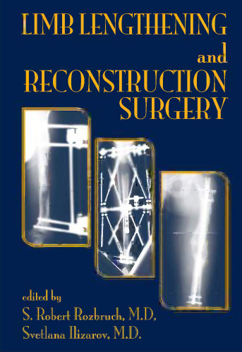 Limb lengthening and reconstructive surgery