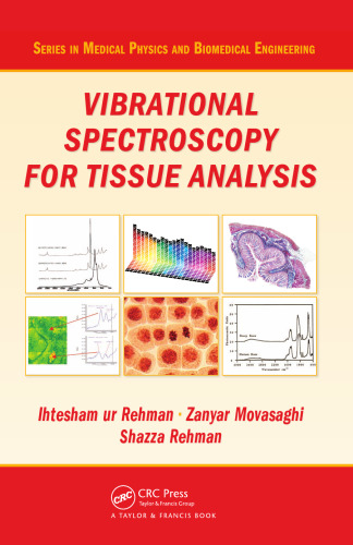 Vibrational spectroscopy for tissue analysis