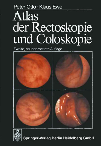 Atlas der Rectoskopie und Coloskopie