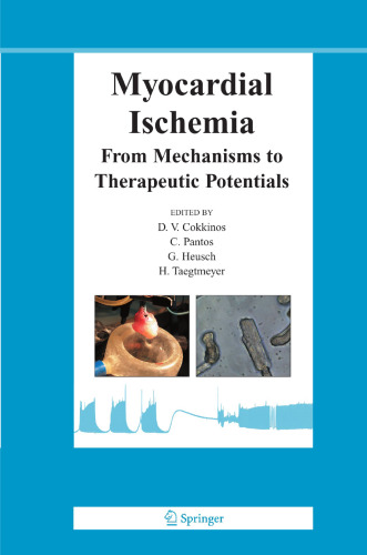 Myocardial Ischemia: From mechanisms to therapeutic potentials