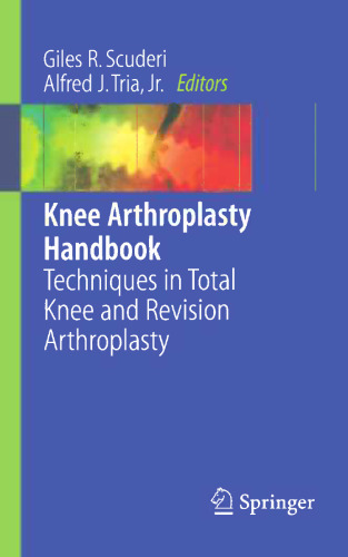 Knee Arthroplasty Handbook: Techniques in Total Knee and Revision Arthroplasty