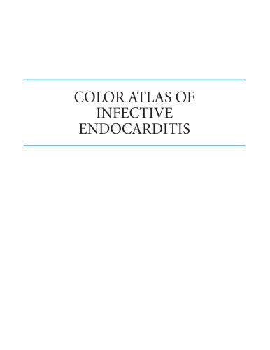 Color Atlas of Infective Endocarditis