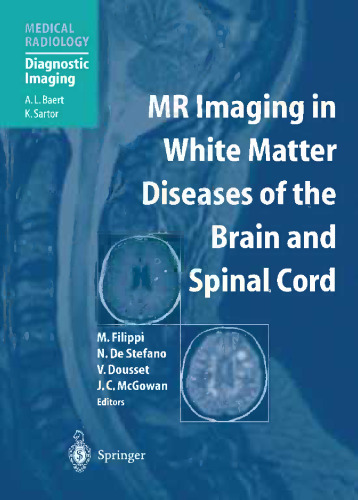 MR Imaging in White Matter Diseases of the Brain and Spinal Cord