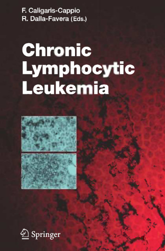 Chronic Lymphocytic Leukemia