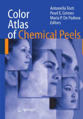 Color Atlas of Chemical Peels