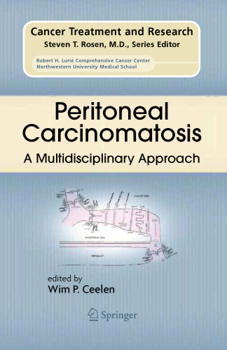 Peritoneal Carcinomatosis: A Multidisciplinary Approach