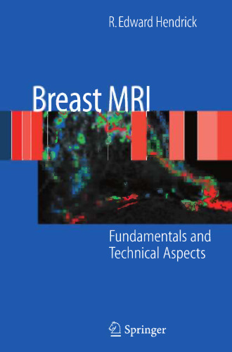 Breast MRI: Fundamentals and Technical Aspects