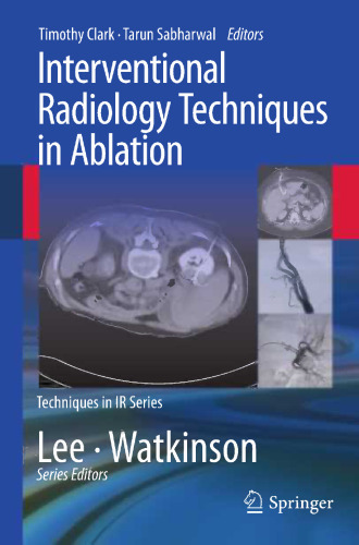 Interventional Radiology Techniques in Ablation